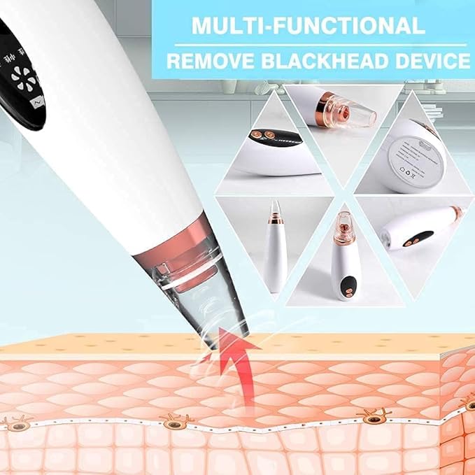 Blackhead Remover Vacuum Pore Cleaner 6 in 1 – Rechargeable Facial Acne & Whitehead Extraction Device