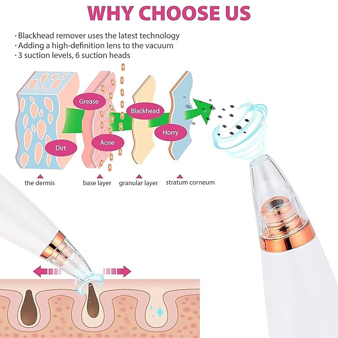 Blackhead Remover Vacuum Pore Cleaner 6 in 1 – Rechargeable Facial Acne & Whitehead Extraction Device